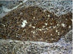 RelA/NFkB p65, p Ser276 Antibody, Novus Biologicals:Antibodies:Primary